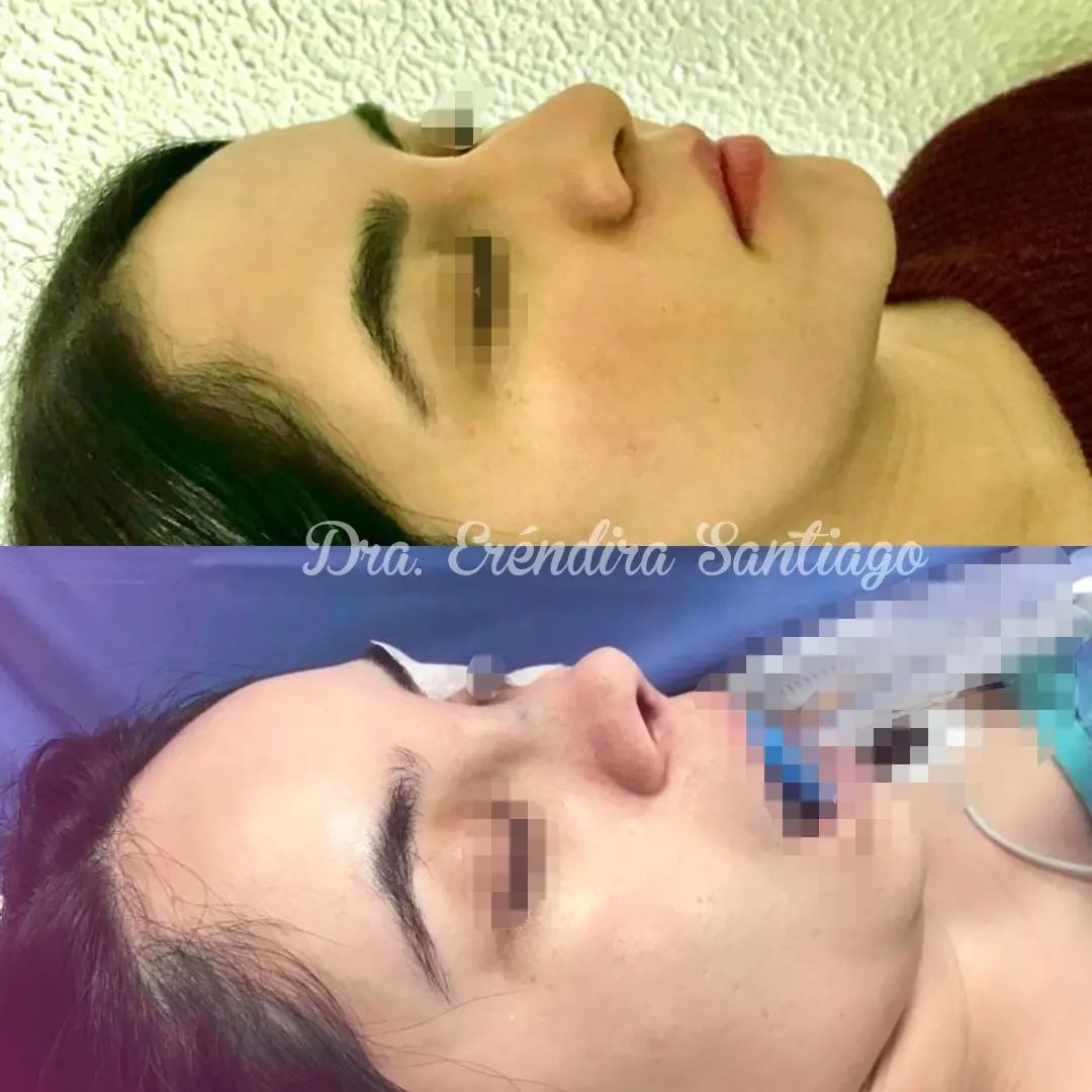 Erendira Santiago Santiesteban-3