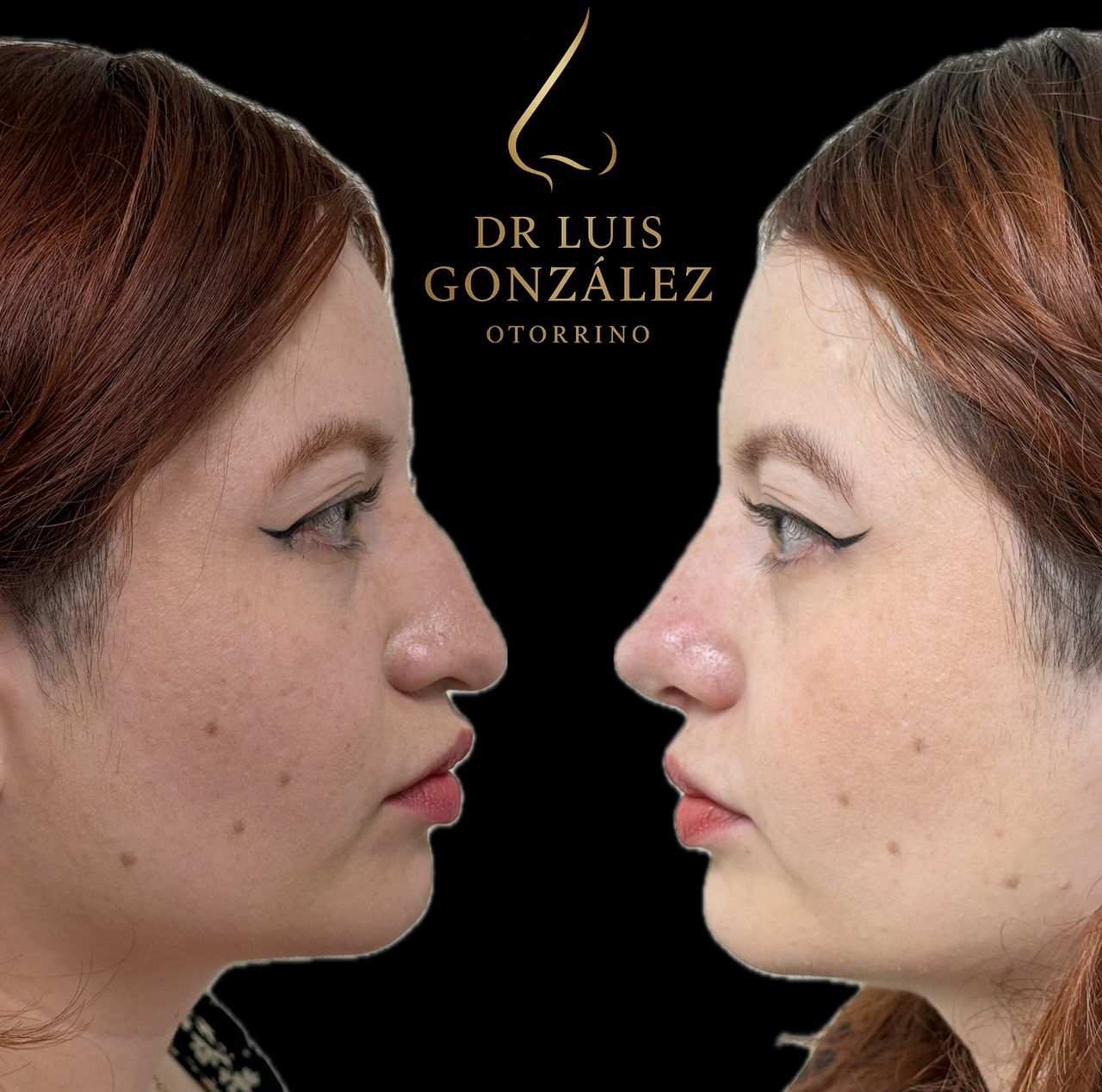 Luis Enrique González Prieto-0