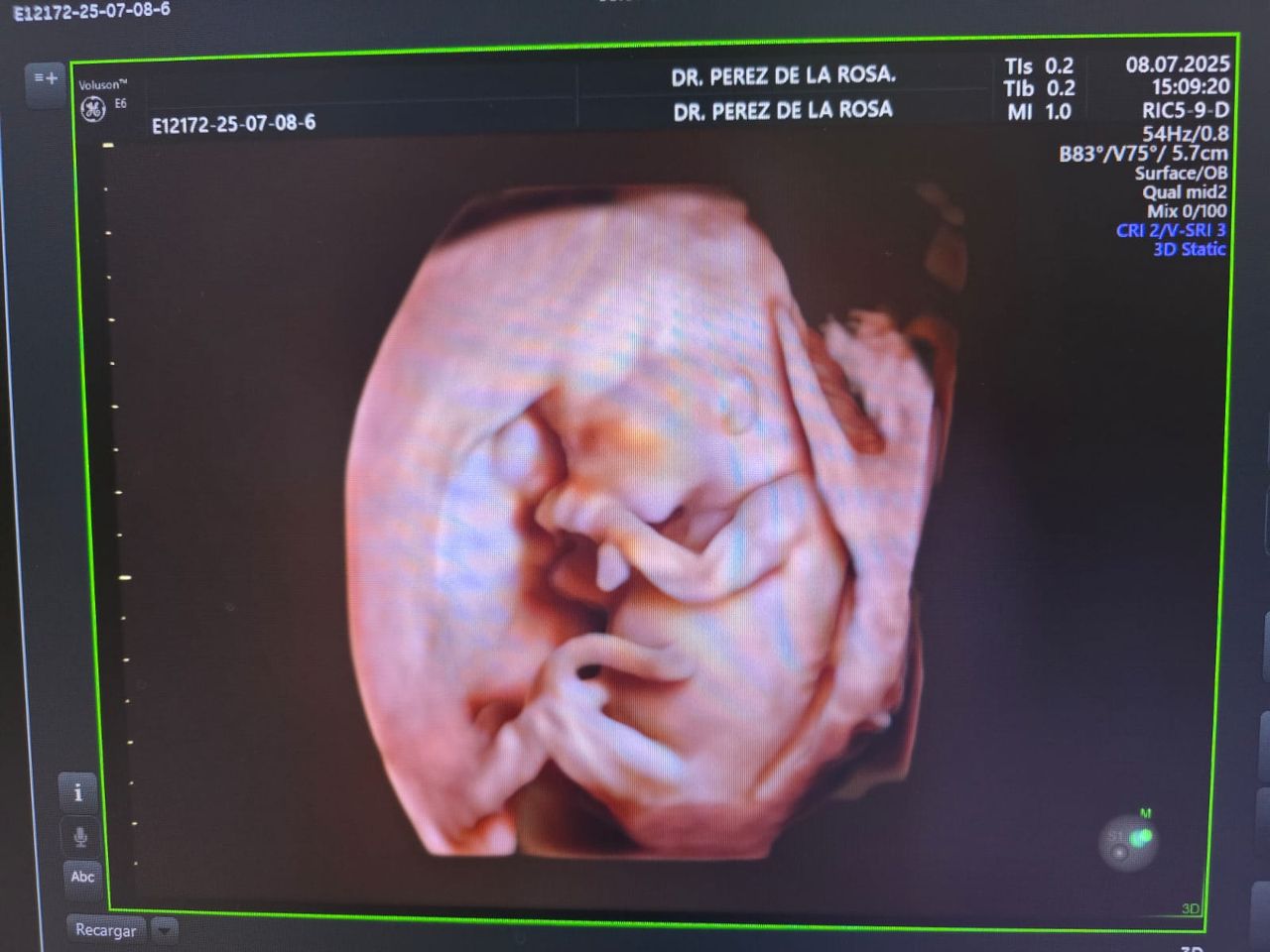 Abraham Ignacio Pérez De La Rosa-8