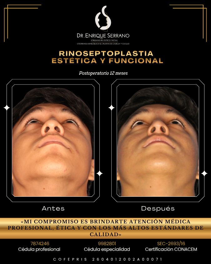Enrique Serrano Cruz-2
