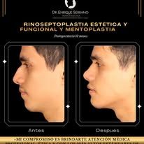 Enrique Serrano Cruz-15