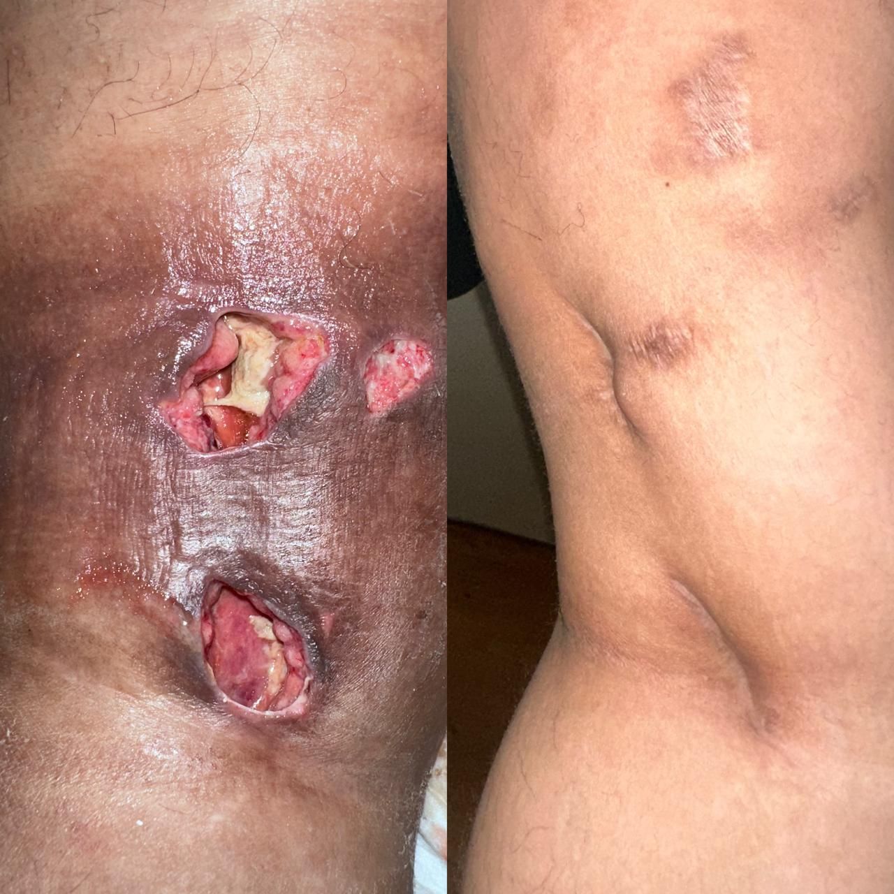 Jhonatan López González-52