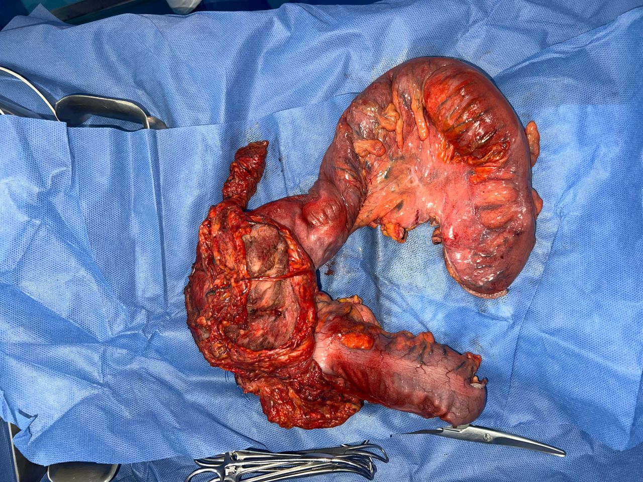 Mateo Ponciano Guerrero-24