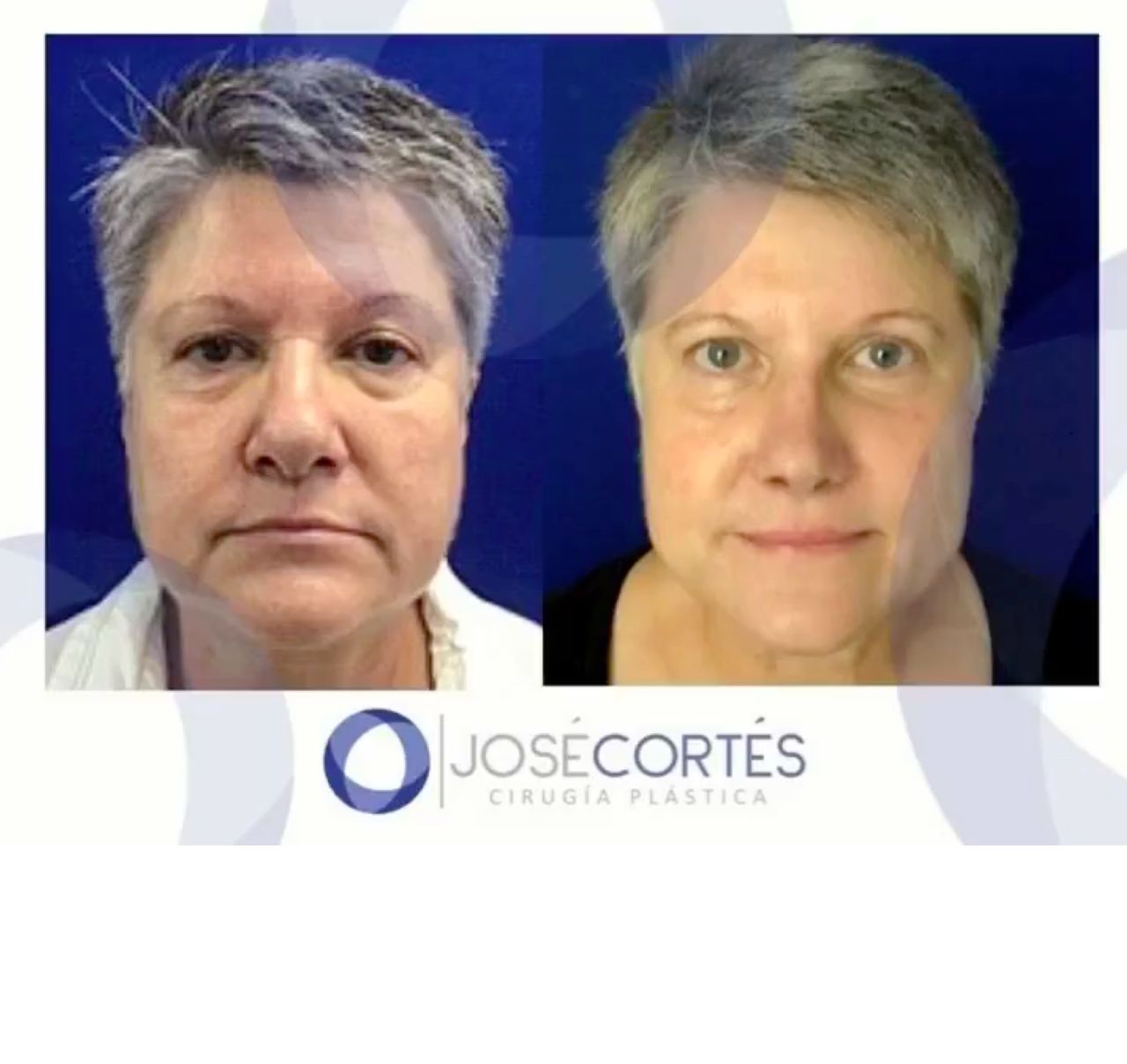 José Cortés Arreguin-10