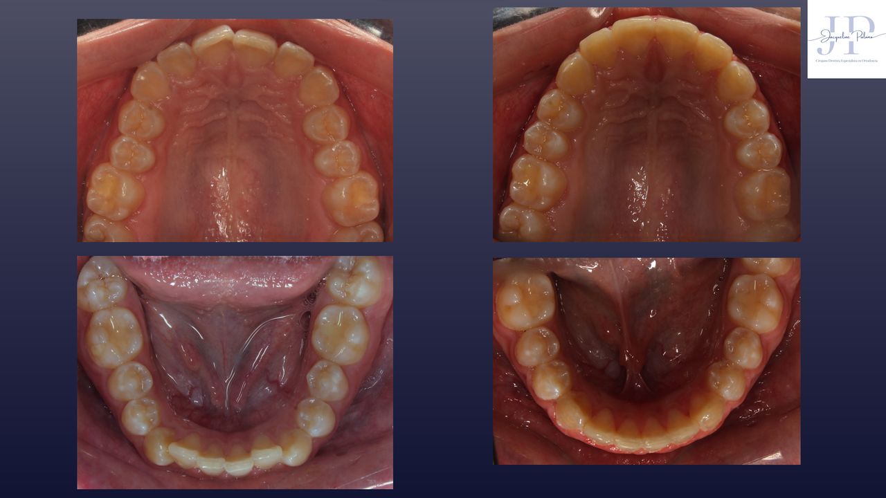 Jacqueline Palomo Meza-2