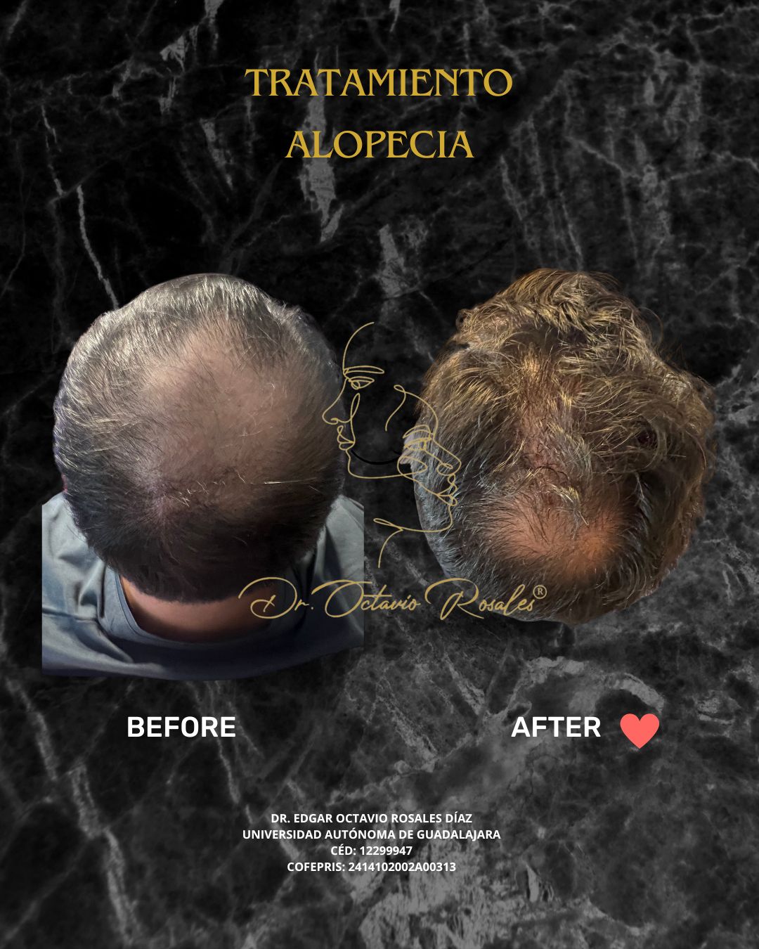 Edgar Octavio Rosales Diaz-10