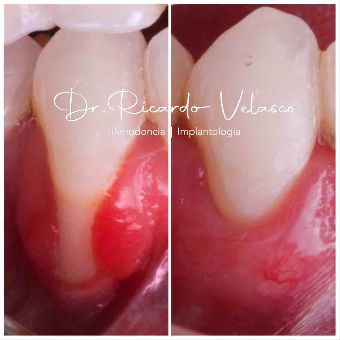 Ricardo Velasco Avelar-9