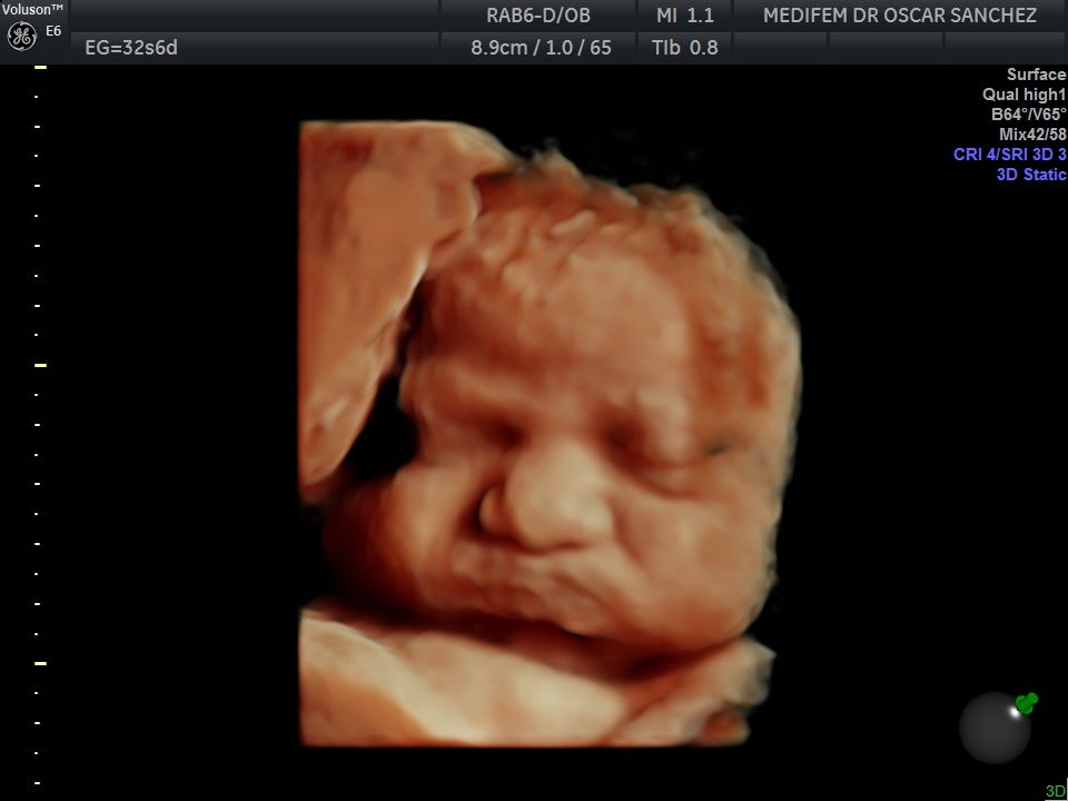 Oscar Alejandro Sánchez Gámez-10