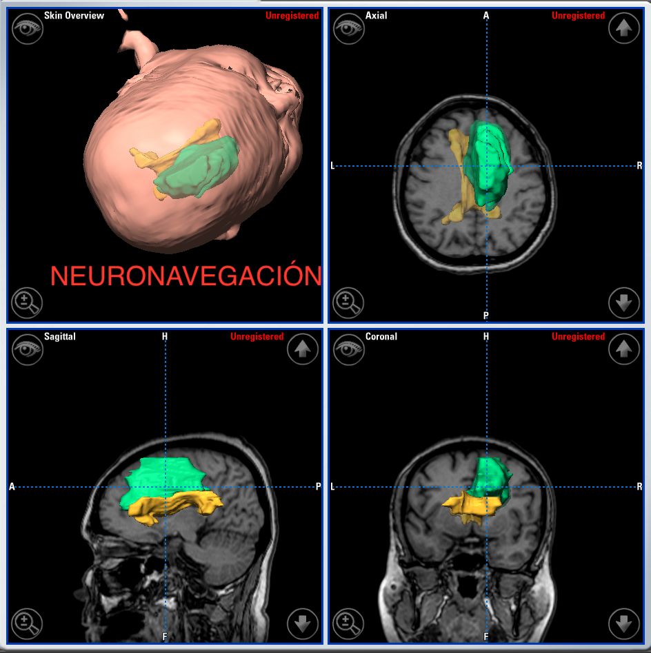 Enrique De Obieta Cruz-30