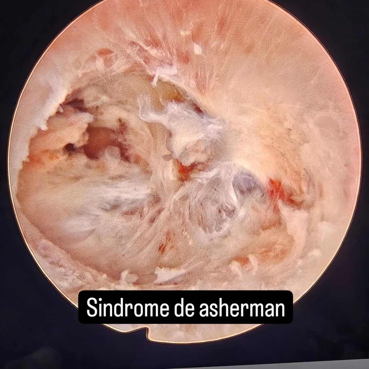 Jorge Alberto Rodriguez Pezino-47