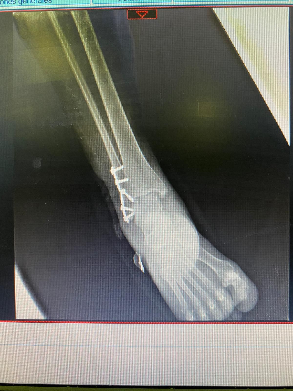 Juan José Luévano De La Cruz-42