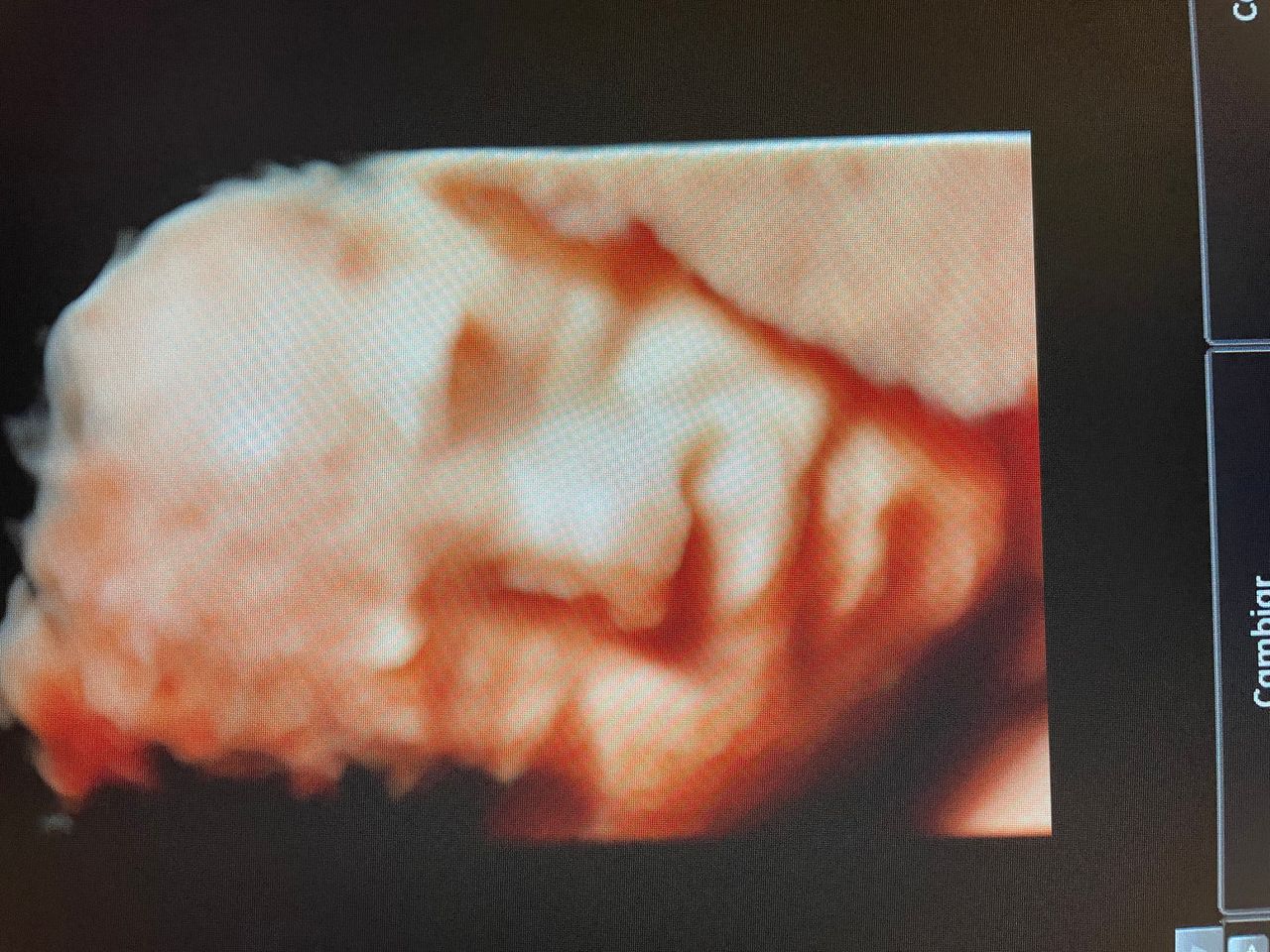 Mayi Mayret Mesquiti-6