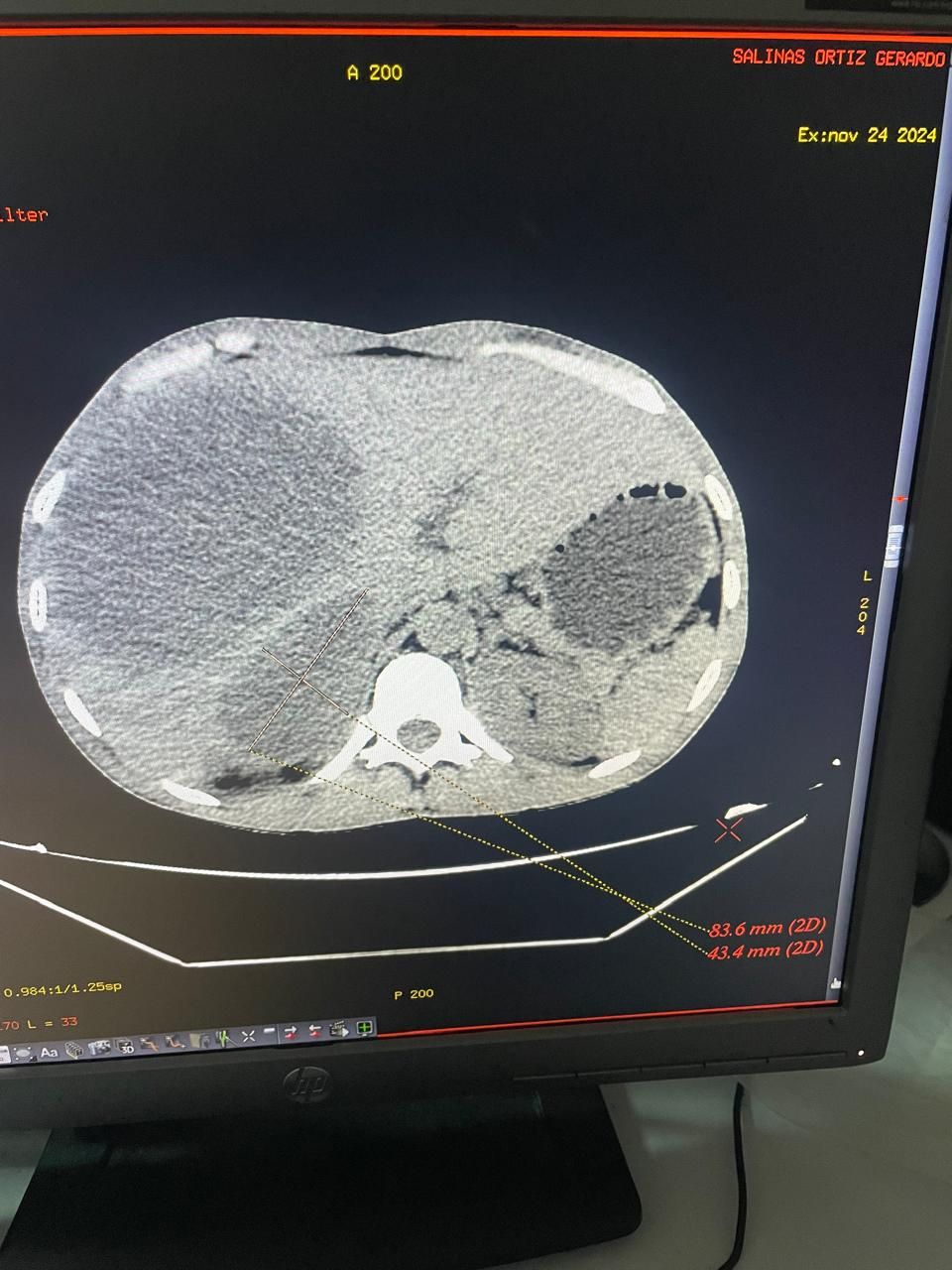Jose Abraham Sauceda Ramirez-13