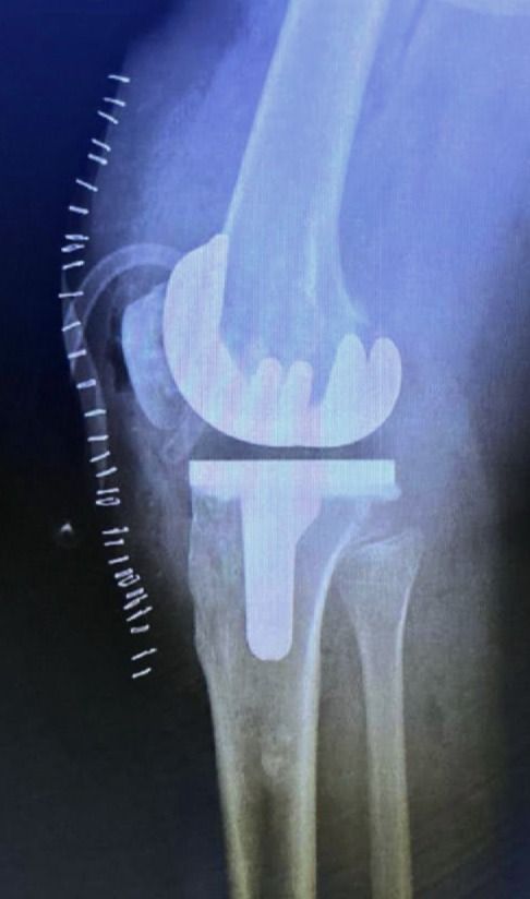 Rubén Rodriguez Acosta-11