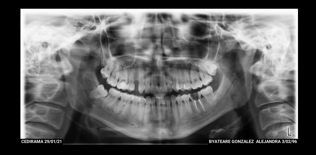 Georgina Zurita Rdz-6