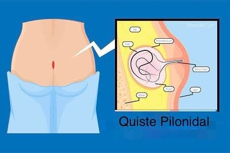 Raúl Mata Arteaga-7