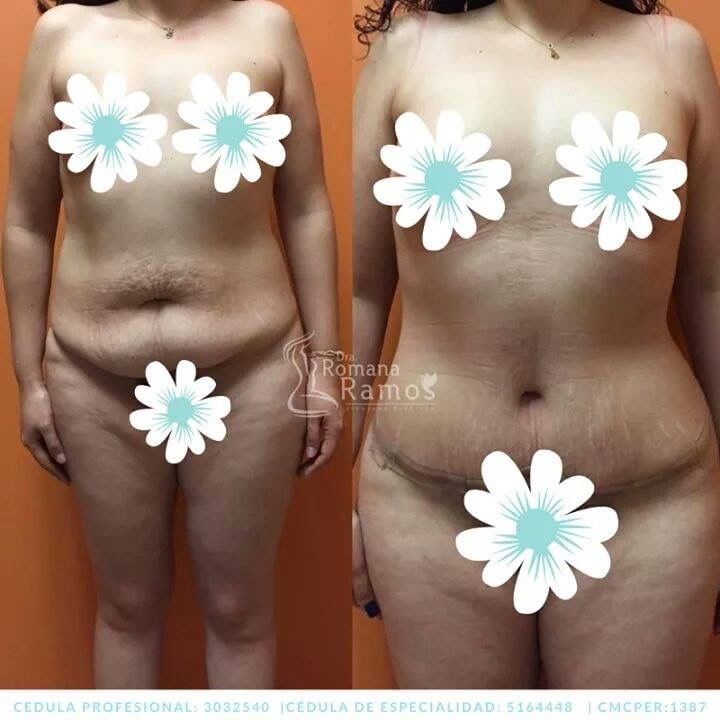 Romana Ramos Cárdenas-40