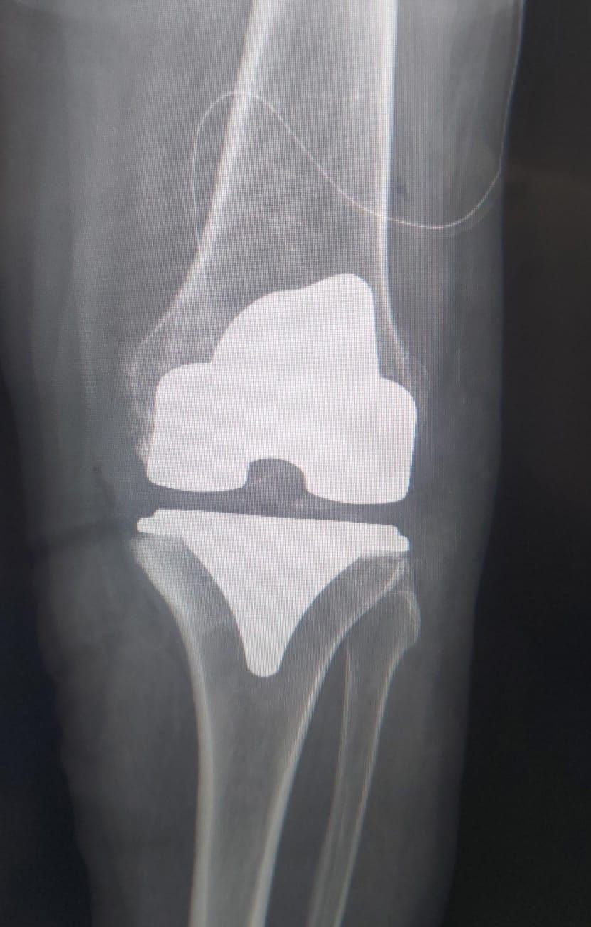 Manuel De Jesús Ambrosio Vicente-0