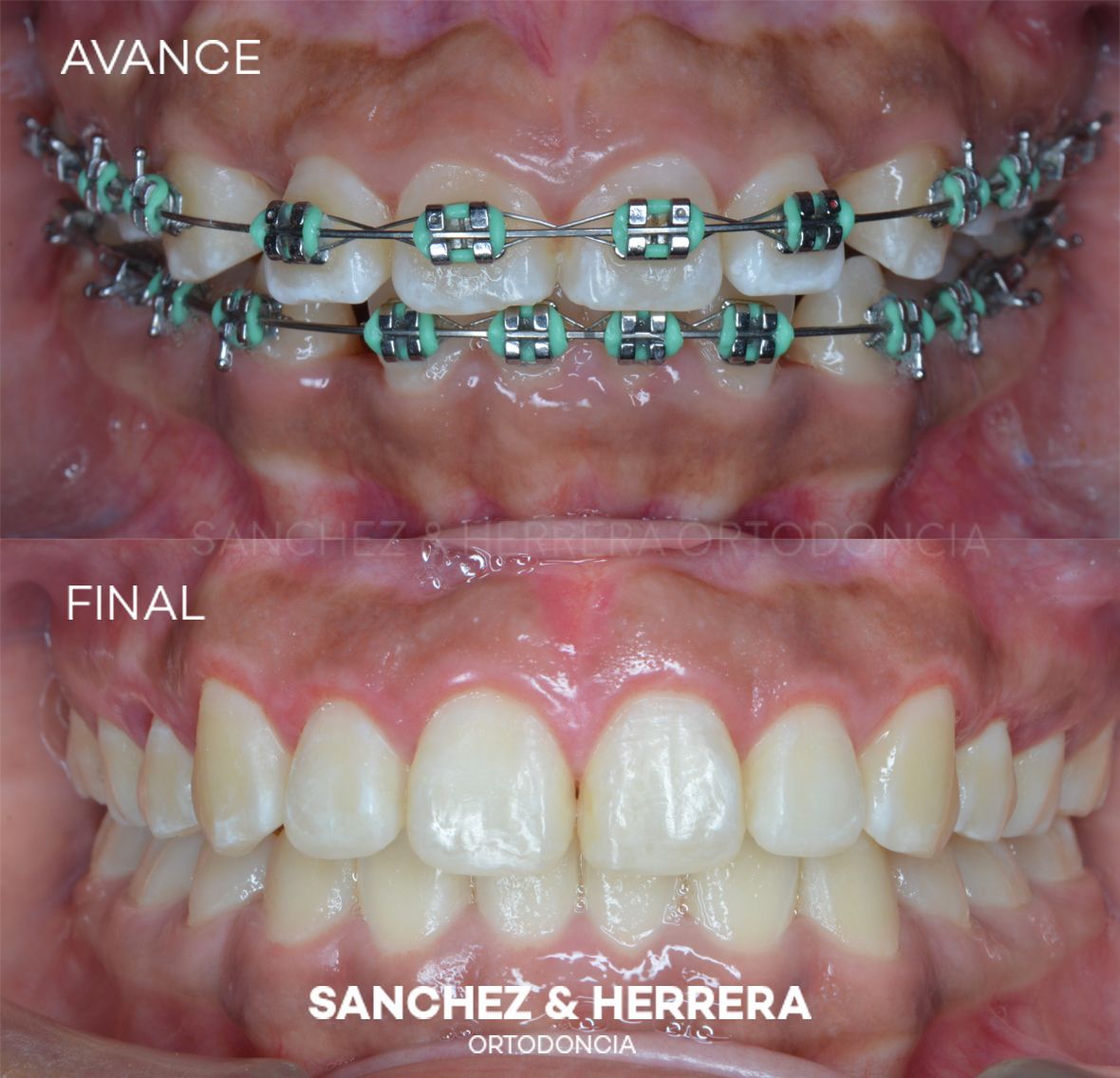 Daniel Sánchez Caamaño-7