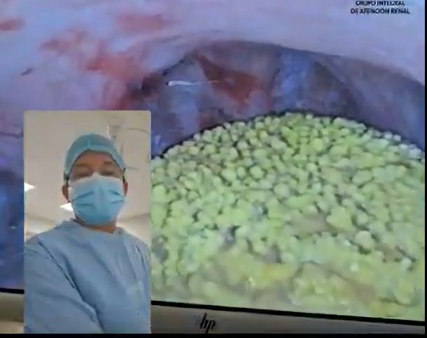 Efrain Barradas Huervo-5