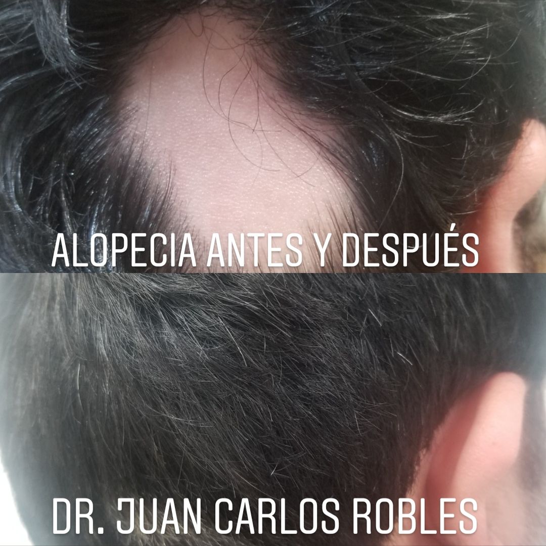 Juan Carlos Robles Méndez-14