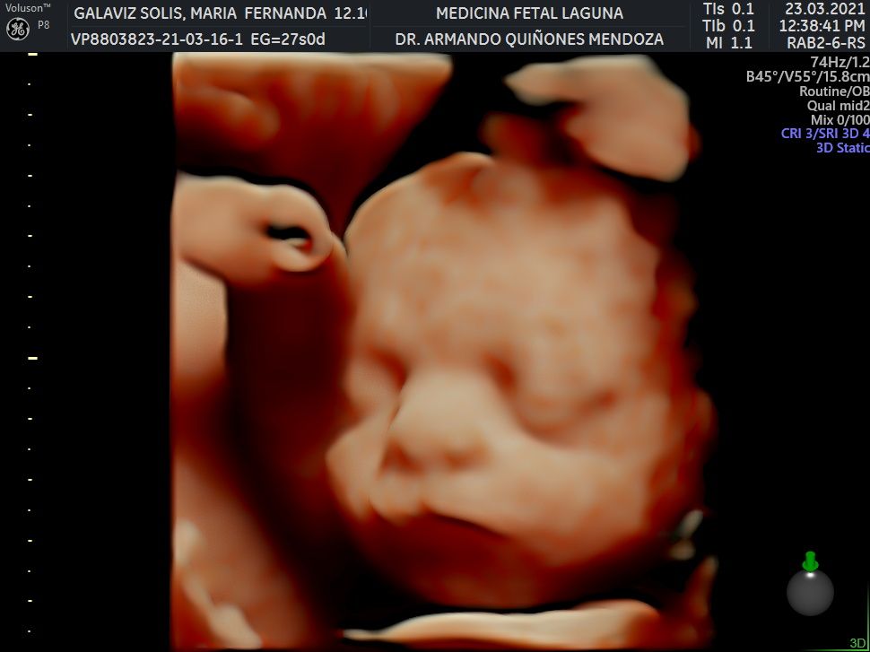 Armando Quiñones Mendoza-9