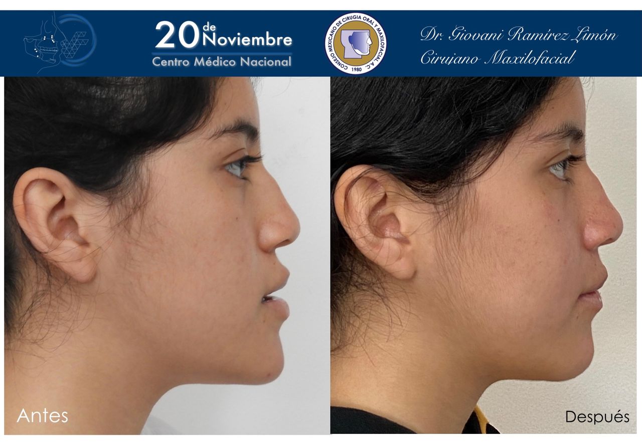 Giovani Ramírez Limón-29