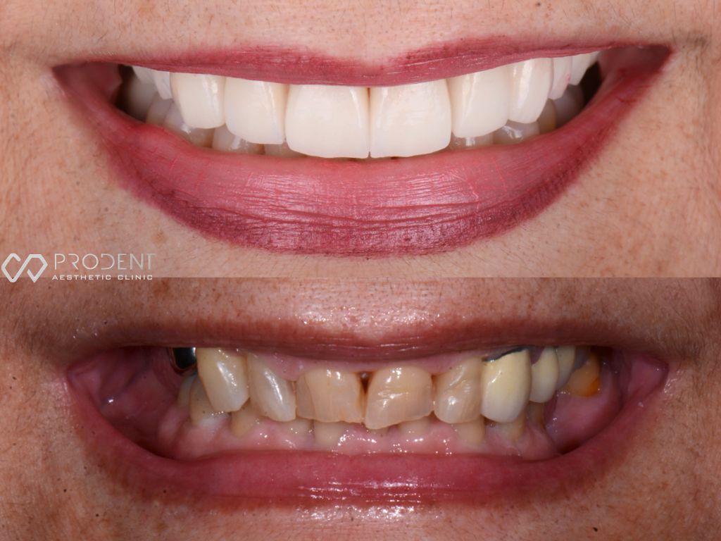 Ulises Pérez Murillo-104