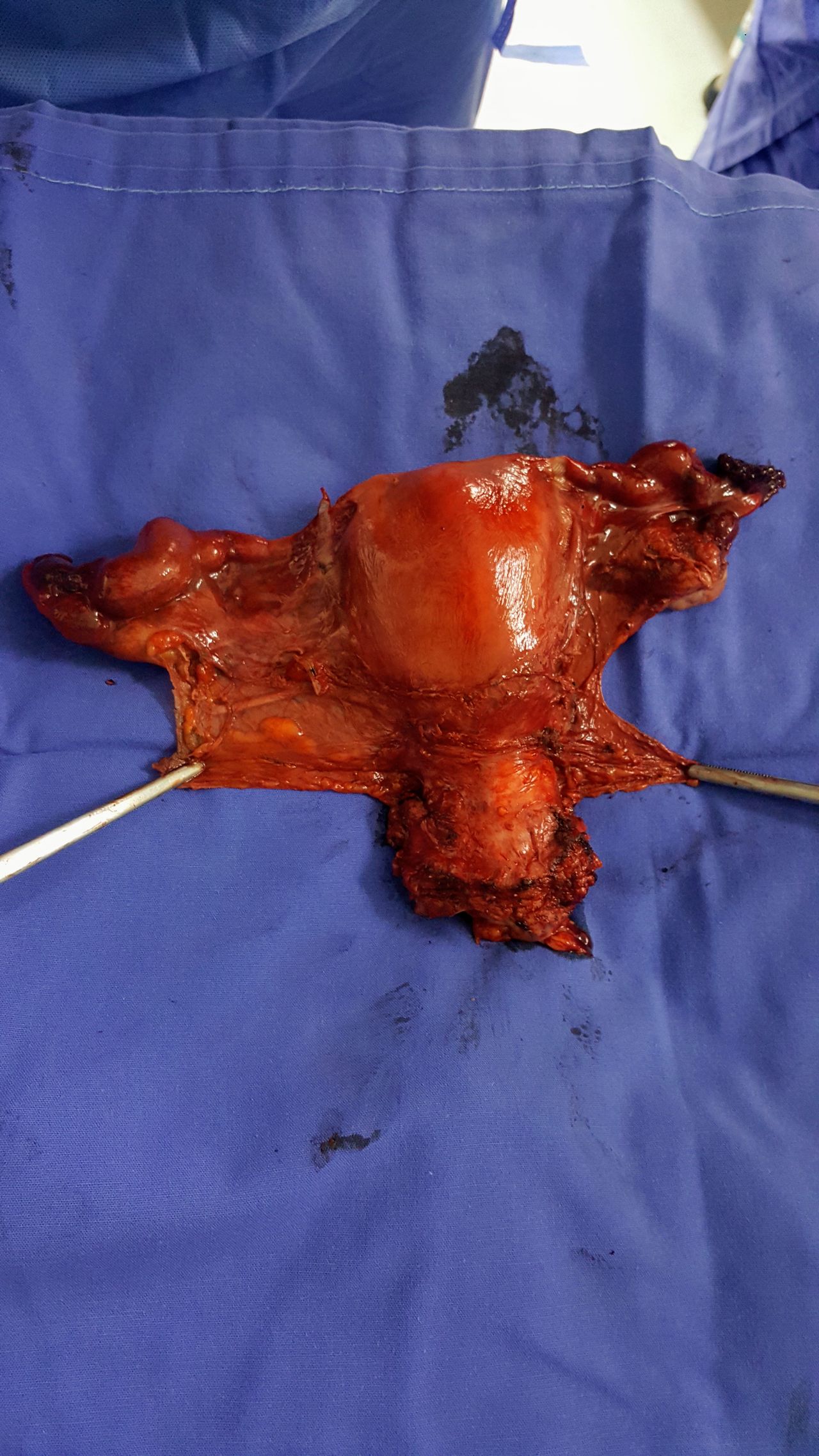 Ángel Millán Juárez-24