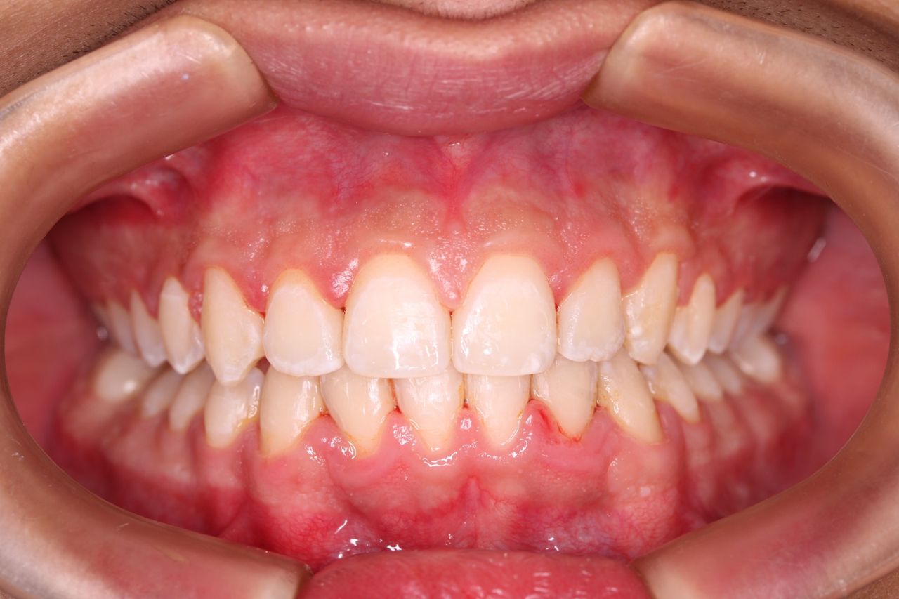 César Osvaldo Poot Chan-5