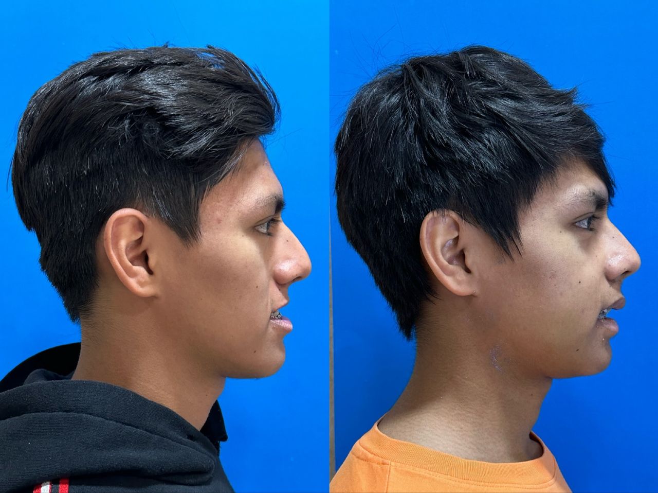 Nancy Valeria Lara Gayosso-5