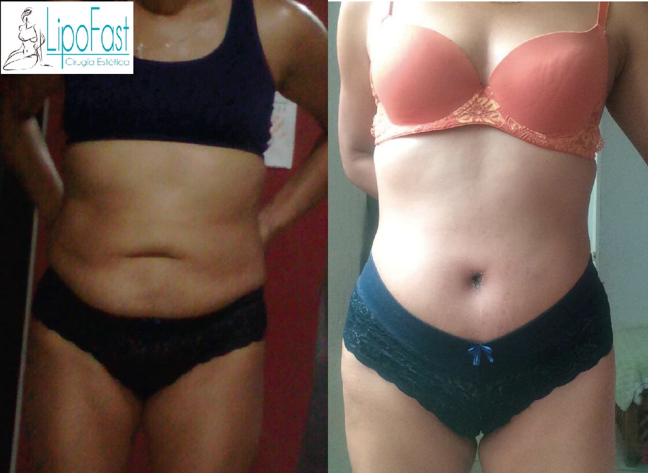 J. Antonio Meré Gómez-14