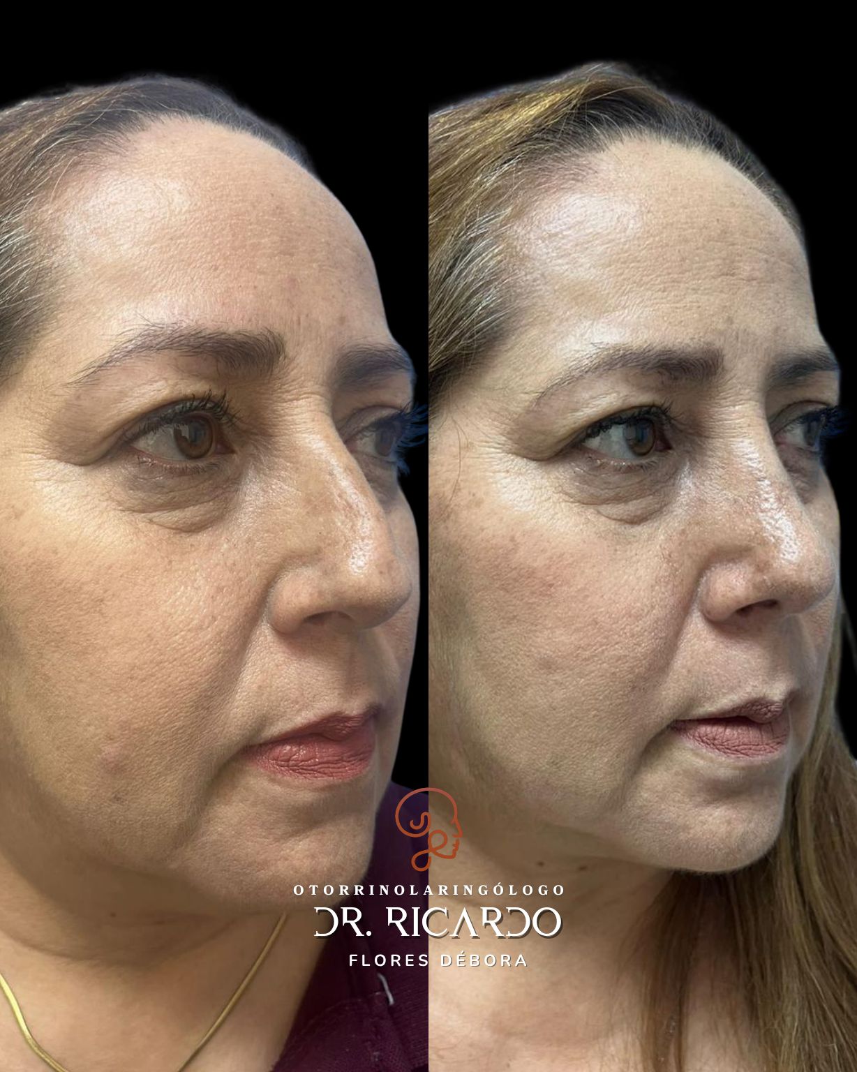 Ricardo Flores Débora-3