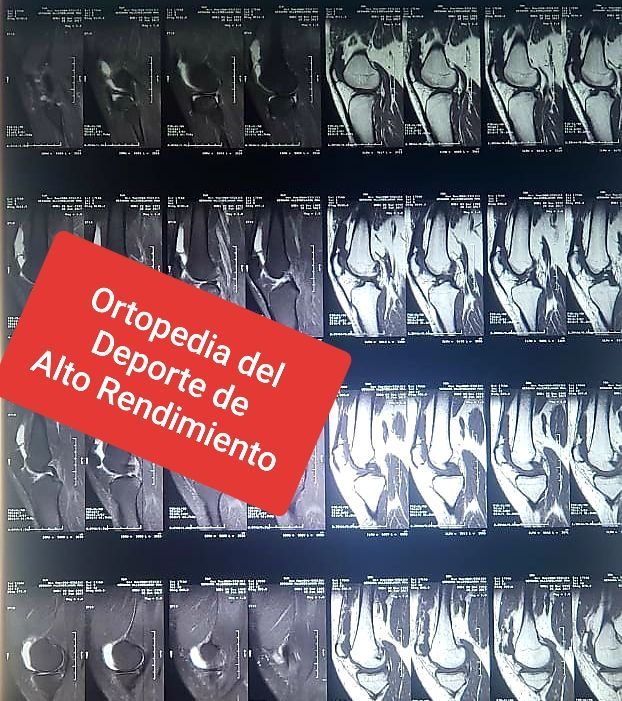 Baltazar Hernandez Mayagoitia-8