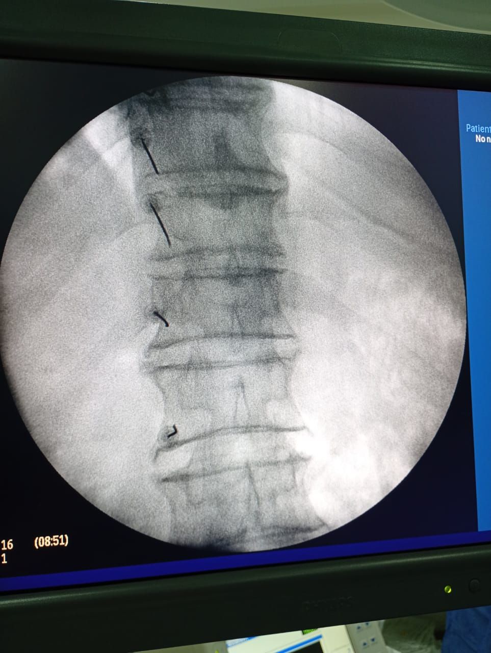 Omar De La Rocha Torres-6