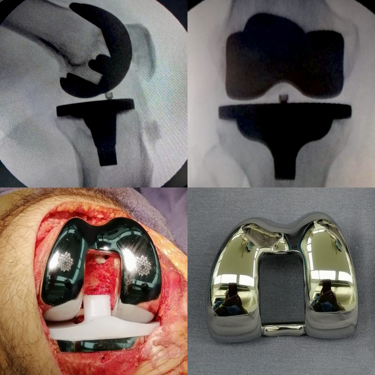 Avelino Colín Vázquez.-3