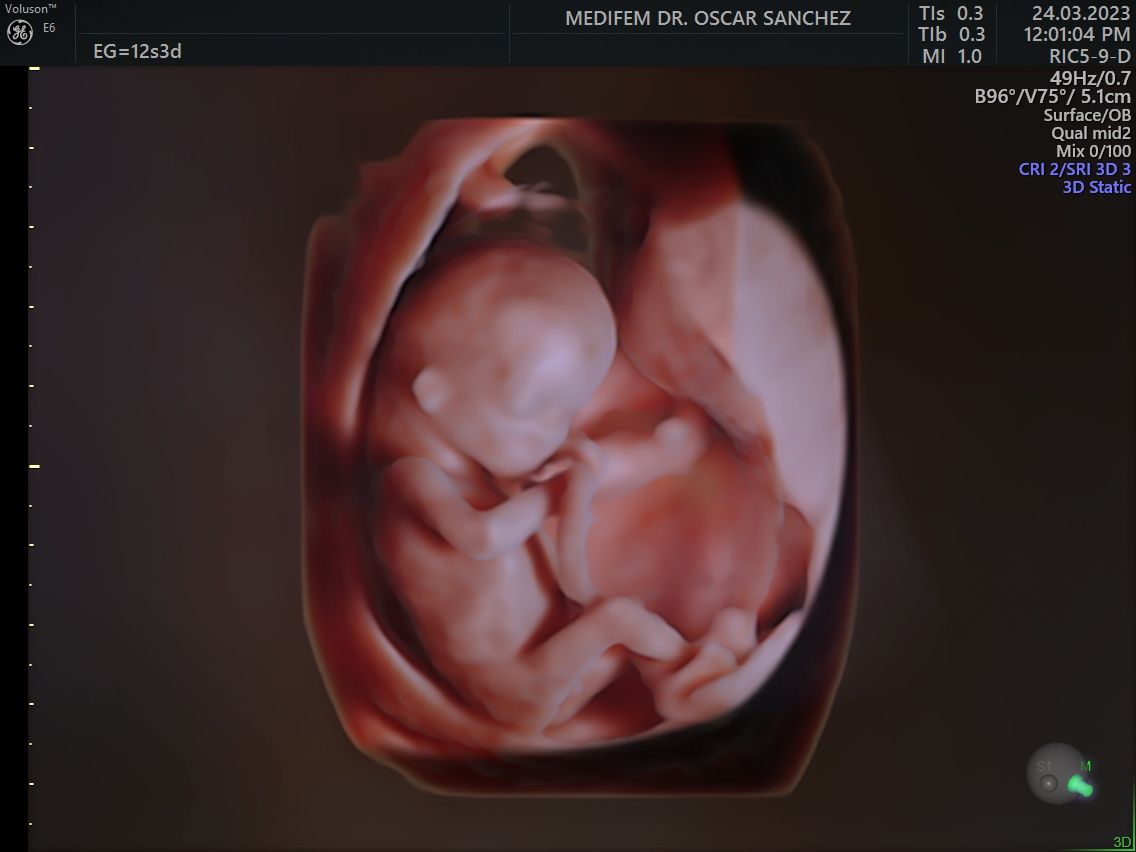 Oscar Alejandro Sánchez Gámez-19