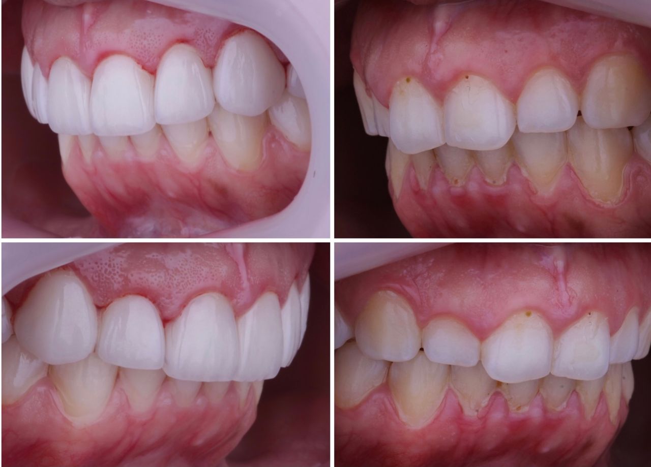 Josué Márquez Gómez-56