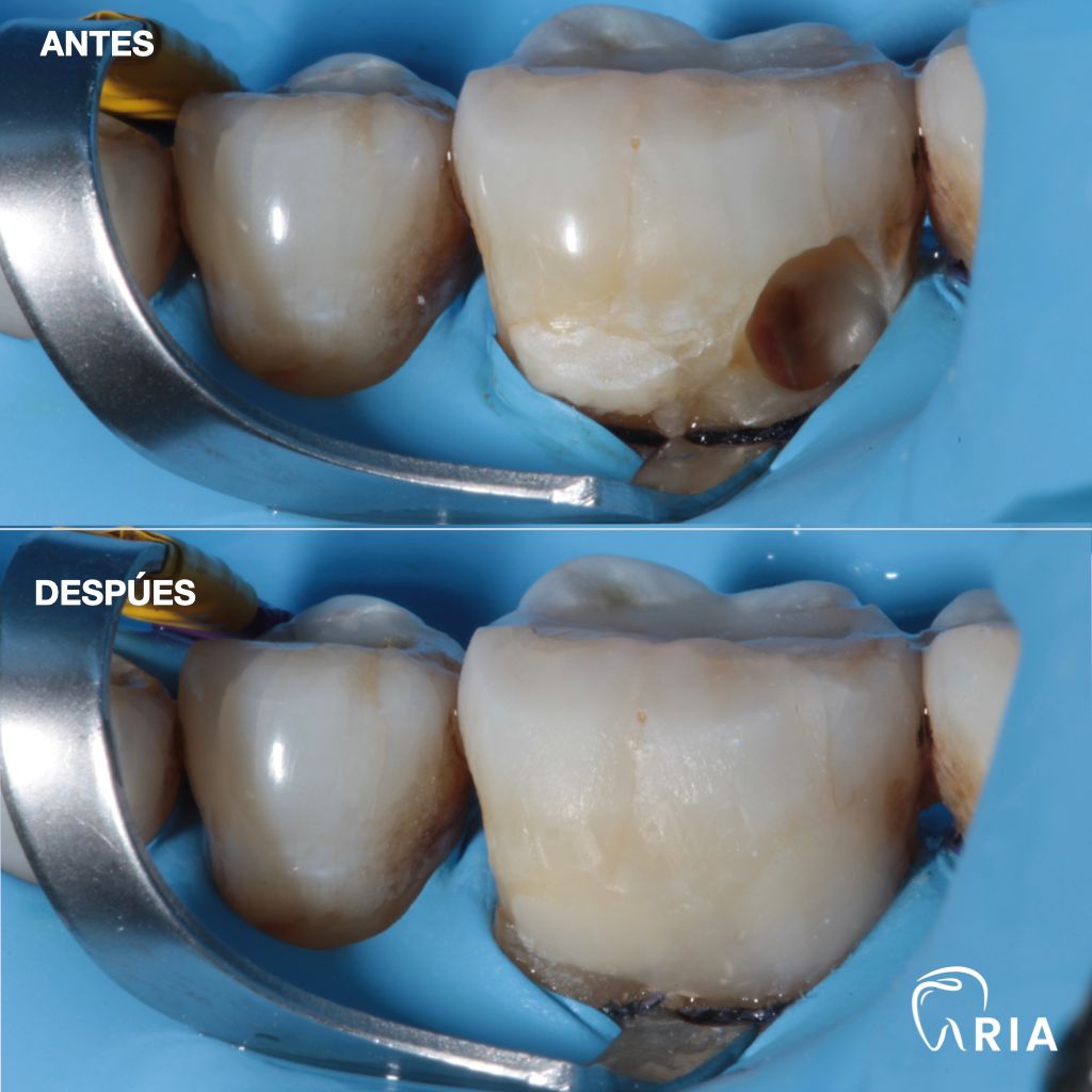 Mariel Itzayani Torres López-28