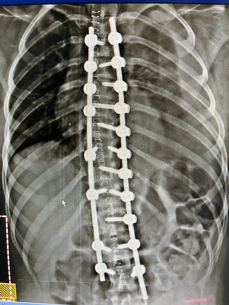 Carlos Tariacuri Valencia Aviles-18