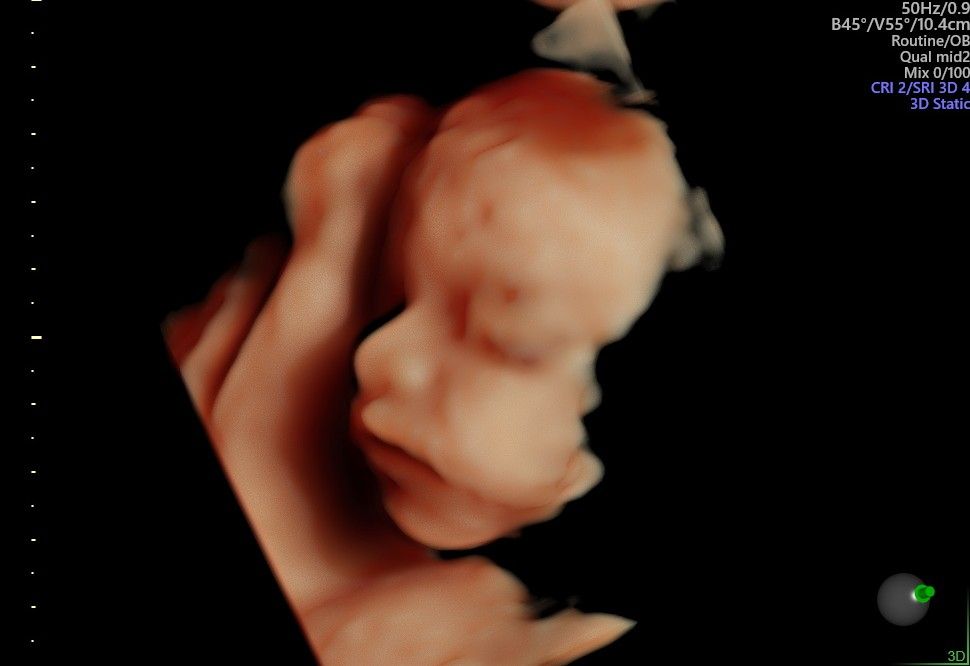 Edelmiro Garza Padilla-4