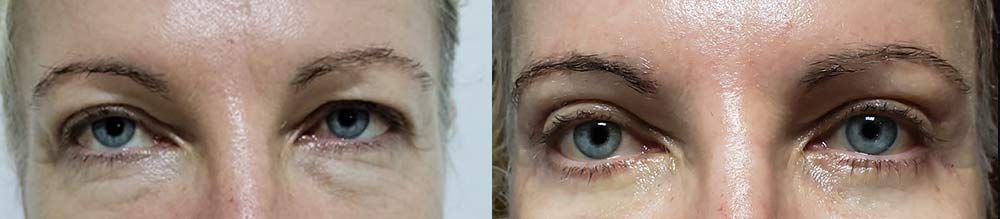 Edgar Ernesto Torres Mejía-20