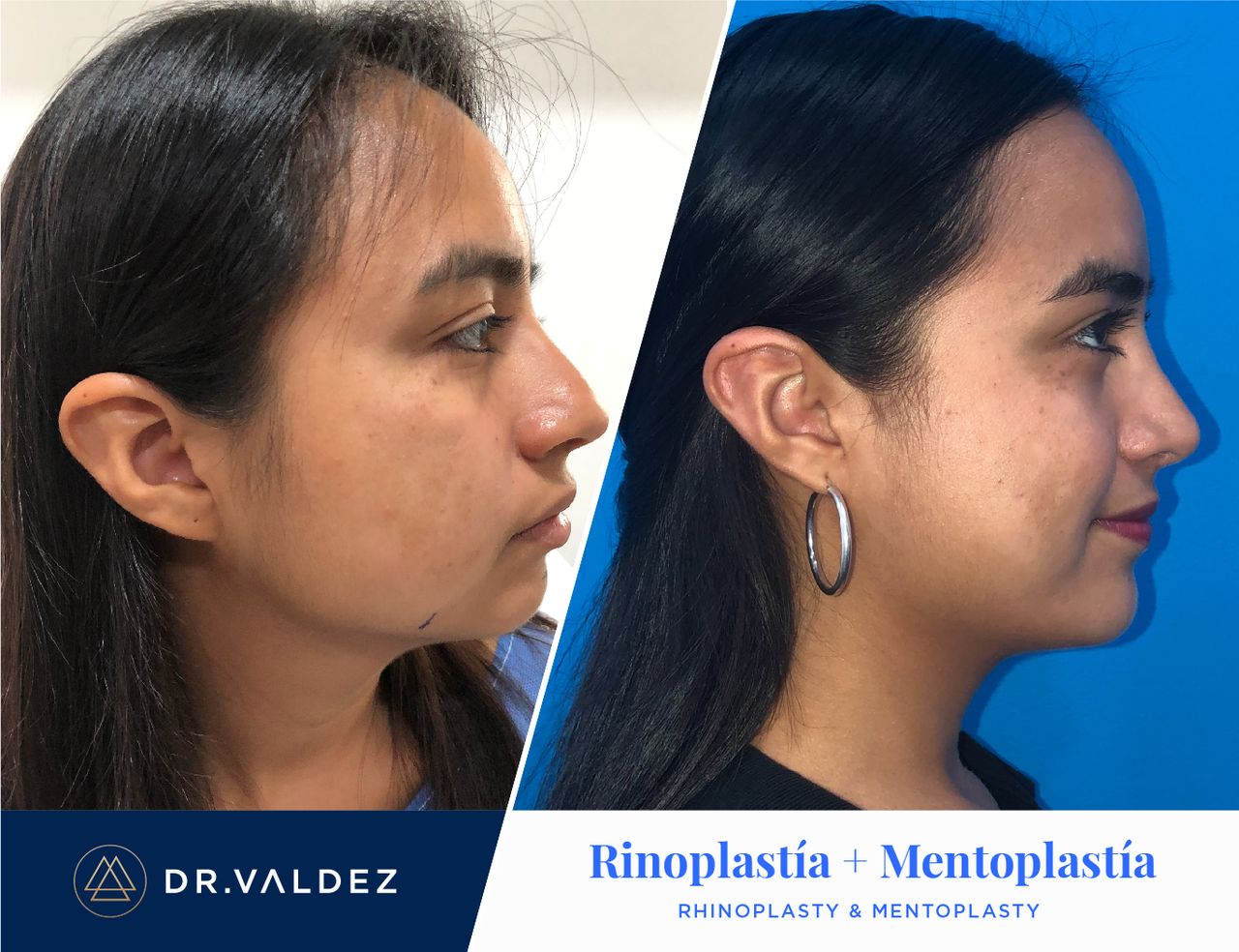 Pedro Arturo Valdez Gomez-14