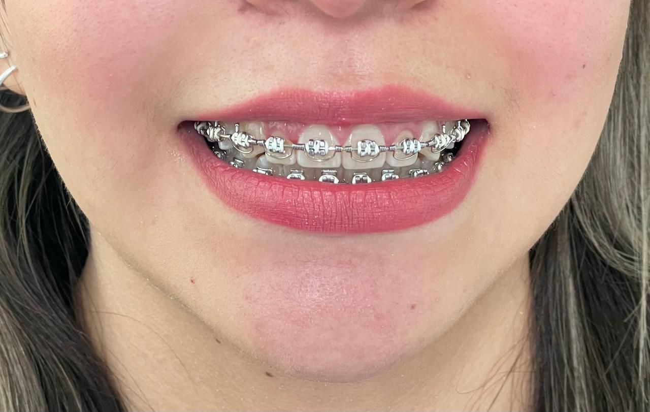 Anuar Becerril Castro-8