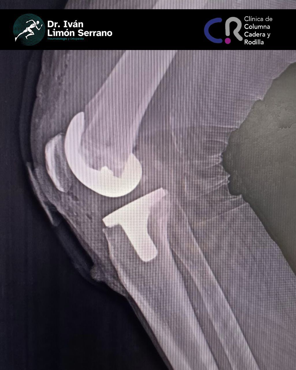 Iván Limón Serrano-32