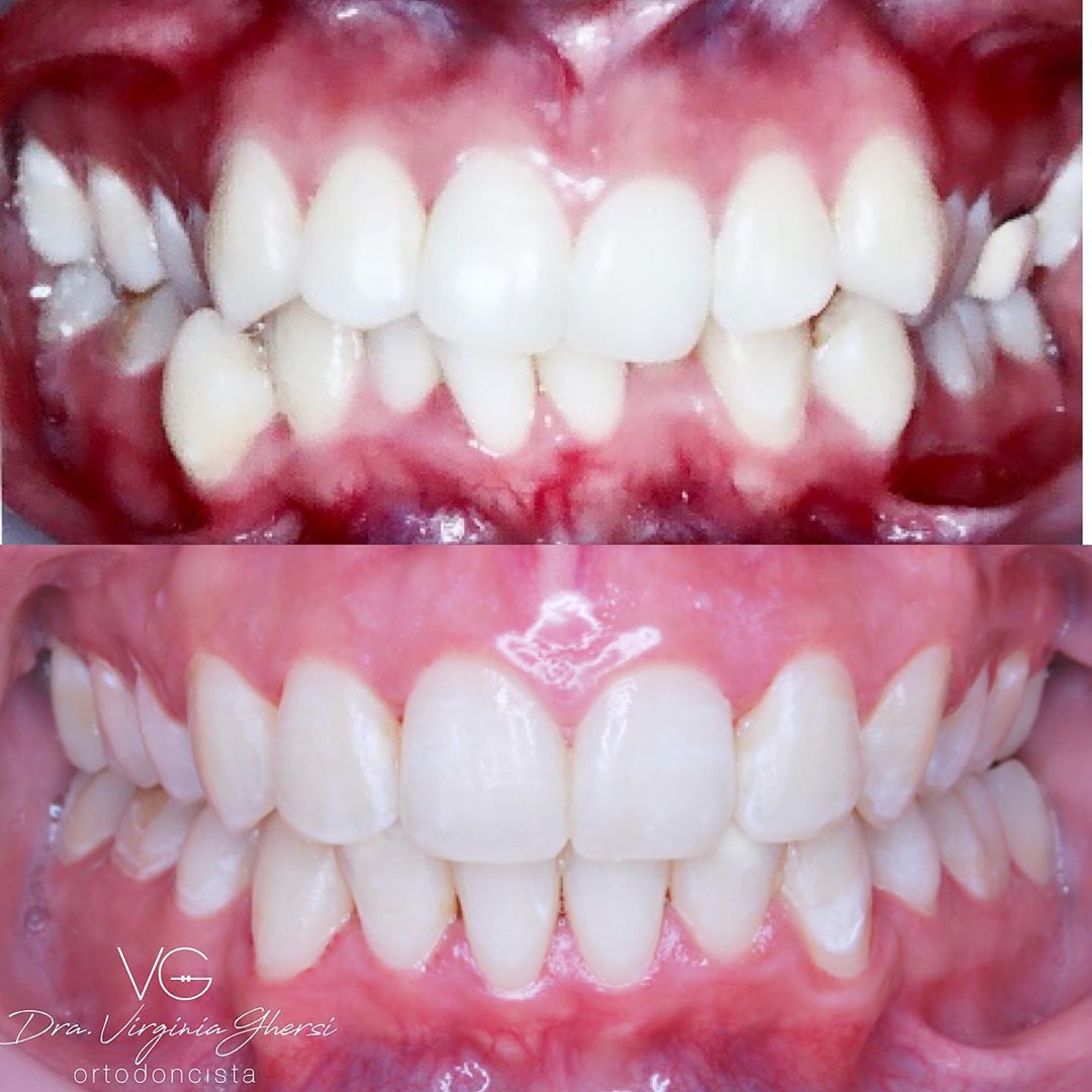 Maria Virginia Ghersi Angulo-8