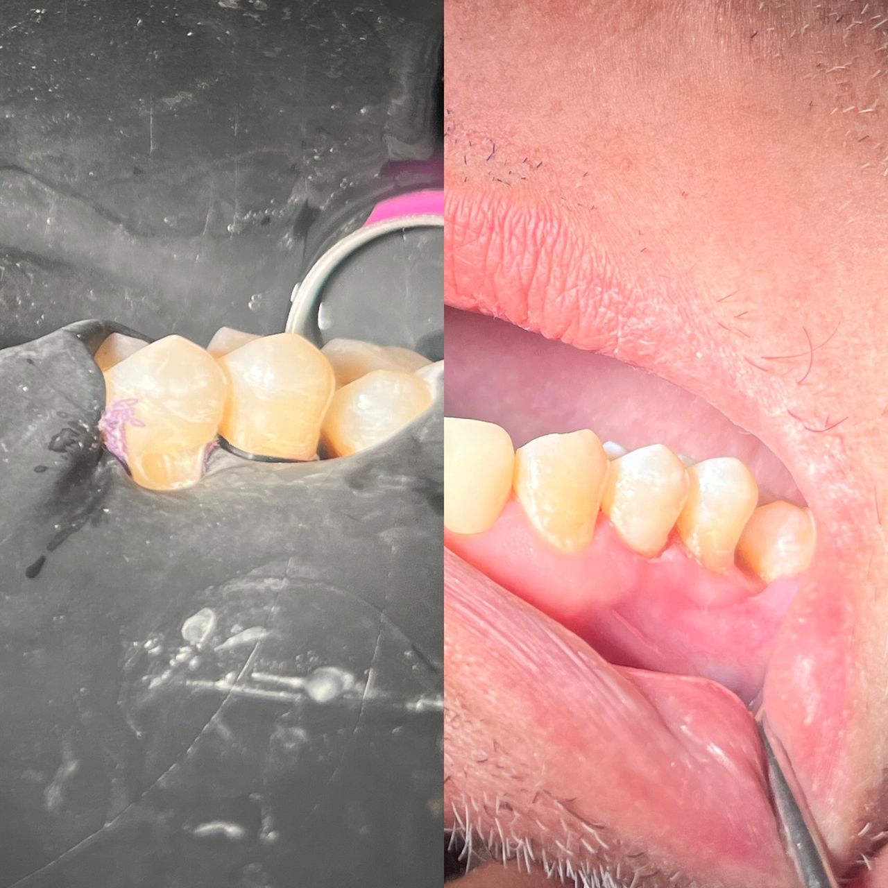 Luis Ángel Ortiz López-21