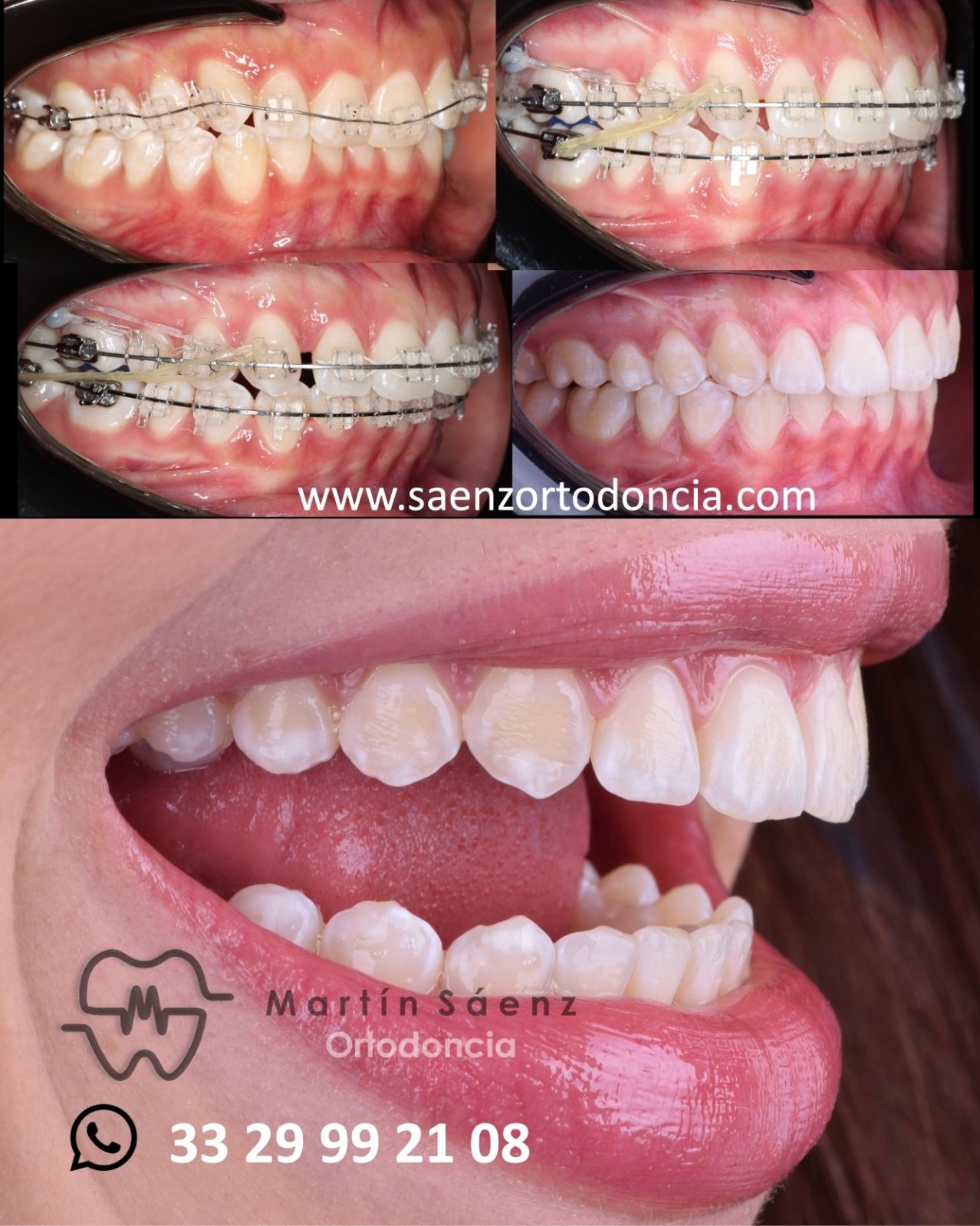 Martín Sáenz Zárate-6