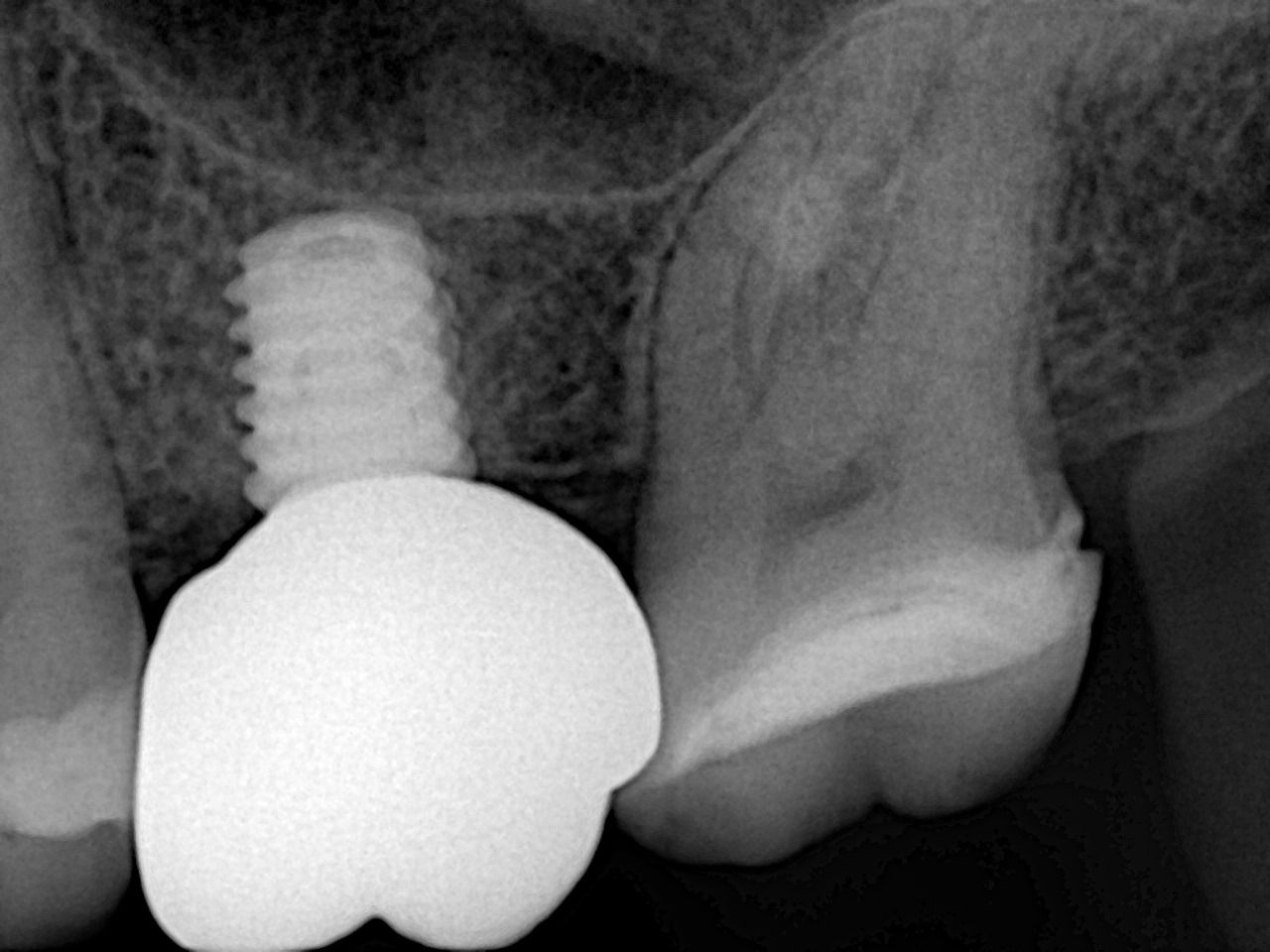 Luis Enrique Cruz Hernández-11