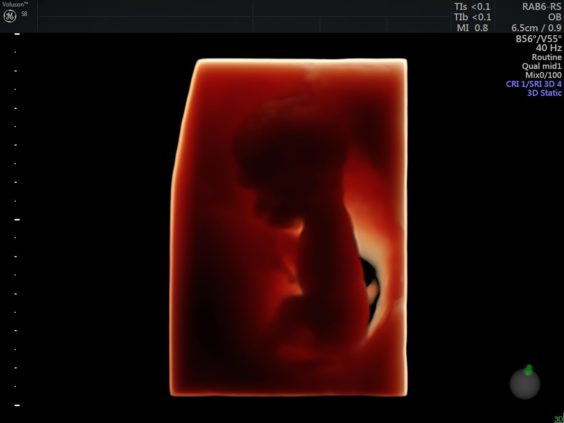 Griselda Reyes Torres-79